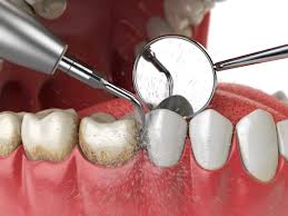 Odontologia Preventiva